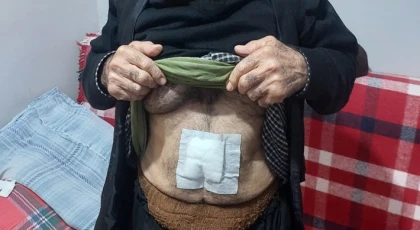Gitmediği hastane kalmadı... Bakın karnından ne çıktı!